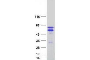 Validation with Western Blot (TACC1 Protein (Transcript Variant 2) (Myc-DYKDDDDK Tag))