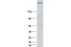 Validation with Western Blot (USP24 Protein (Myc-DYKDDDDK Tag))