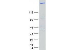 Validation with Western Blot (USP24 Protein (Myc-DYKDDDDK Tag))