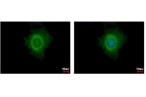 ICC/IF Image DDX6 antibody detects DDX6 protein at cytoplasm and P body by immunofluorescent analysis. (DDX6 antibody  (Center))