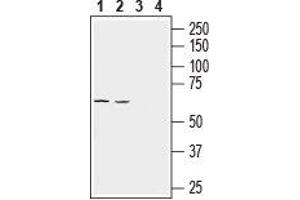 Western blot analysis of rat lung (lanes 1 and 3) and mouse lung (lanes 2 and 4) lysates: - 1, 2. (SLC43A1 antibody  (4th Extracellular Loop))