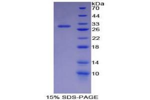 SDS-PAGE analysis of Mouse IKBIP Protein. (IKbIP Protein)