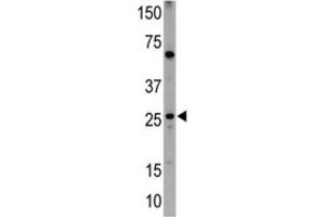 Western Blotting (WB) image for anti-BCL2/adenovirus E1B 19kDa Interacting Protein 1 (BNIP1) (BH3 Domain) antibody (ABIN2997180) (BNIP1 antibody  (BH3 Domain))