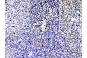 IHC analysis of IL12B using anti-IL12B antibody . (IL12B antibody  (AA 23-250))
