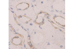 Figure. (CD93 antibody  (AA 227-493))