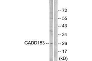Western blot analysis of extracts from LOVO cells, treated with serum 10% 15', using GADD153 Antibody. (DDIT3 antibody  (AA 91-140))