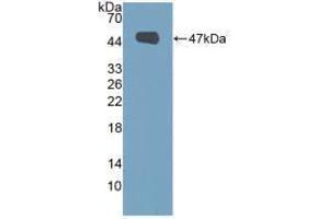 Western blot analysis of recombinant Human MUC1. (MUC1 antibody  (AA 1098-1255))
