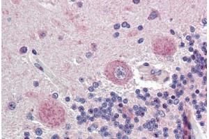 Brain, cerebellum, Human: Formalin-Fixed, Paraffin-Embedded (FFPE) (Fatty Acid Synthase antibody  (AA 2118-2129))