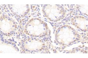 Immunohistochemistry (IHC) image for anti-Acidic (Leucine-Rich) Nuclear phosphoprotein 32 Family, Member A (ANP32A) (AA 2-175) antibody (ABIN7437665)