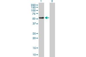 Western Blot analysis of OSMR expression in transfected 293T cell line by OSMR MaxPab polyclonal antibody. (Oncostatin M Receptor antibody  (AA 1-342))