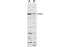 DCUN1D2 antibody  (N-Term)