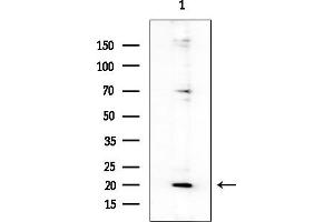anti-Arginine Vasopressin (AVP) antibody