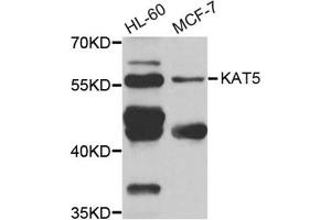 Western Blotting (WB) image for anti-K(lysine) Acetyltransferase 5 (KAT5) antibody (ABIN1980157) (KAT5 antibody)