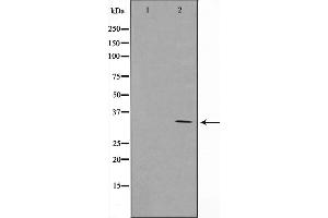 Western blot analysis on Jurkat cell lysate using Cyclin G Antibody,The lane on the left is treated with the antigen-specific peptide. (Cyclin G1 antibody  (Internal Region))