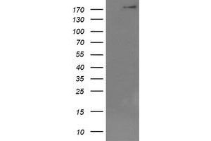 Image no. 1 for anti-Dedicator of Cytokinesis 8 (DOCK8) (AA 833-1160) antibody (ABIN1491684) (DOCK8 antibody  (AA 833-1160))