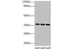 Western blot All lanes: Apoe antibody at 2 μg/mL Lane 1: Mouse liver tissue Lane 2: Mouse brain tissue Lane 3: Mouse lung tissue Secondary Goat polyclonal to rabbit IgG at 1/10000 dilution Predicted band size: 36 kDa Observed band size: 36 kDa (APOE antibody  (AA 19-311))