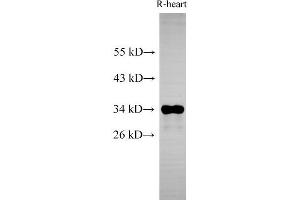 Western Blot analysis of Rat heart using Cytochrome c1 Polyclonal Antibody at dilution of 1:500 (Cytochrome C1 antibody)