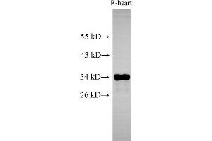 Western Blot analysis of Rat heart using Cytochrome c1 Polyclonal Antibody at dilution of 1:500