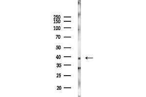 anti-Solute Carrier Family 16 (Monocarboxylic Acid Transporters), Member 3 (SLC16A3) (Internal Region) antibody