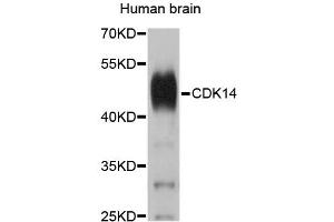 Western blot analysis of extracts of human brain, using CDK14 antibody (ABIN1874104). (CDK14 antibody)