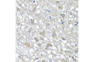Immunohistochemistry of paraffin-embedded rat brain using VPS37A antibody at dilution of 1:100 (x40 lens). (VPS37A antibody)