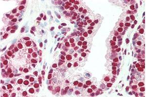 ABIN184657 (5µg/ml) staining of paraffin embedded Human Prostate. (PLRG1 antibody  (C-Term))