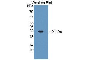 Detection of Recombinant RBM3, Human using Polyclonal Antibody to RNA Binding Motif Protein 3 (RBM3) (RBM3 antibody  (AA 1-157))