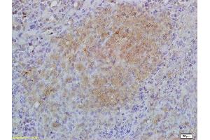 Formalin-fixed and paraffin embedded mouse lymphoma labeled with Anti-IL-17RA/CD217 Polyclonal Antibody, Unconjugated (ABIN747908) at 1:200 followed by conjugation to the secondary antibody and DAB staining (IL17RA antibody  (AA 201-300))