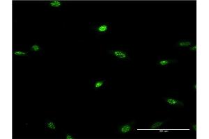 Immunofluorescence of monoclonal antibody to LHX2 on HeLa cell. (LHX2 antibody  (AA 1-76))