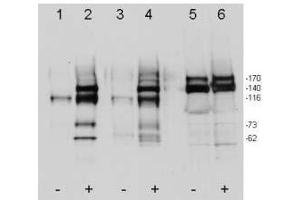 Western blot using ’s affinity purified anti-c-Met pY1349pY1356 antibody shows detection of phosphorylated c-Met. (c-MET antibody  (pTyr1249, pTyr1356))