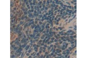 IHC-P analysis of Human Tissue, with DAB staining. (KIR2DS4 antibody  (AA 22-302))
