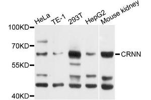 Western blot analysis of extracts of various cell lines, using CRNN antibody (ABIN5996070) at 1/1000 dilution.
