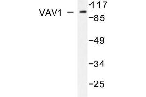 Image no. 2 for anti-Vav 1 Oncogene (VAV1) antibody (ABIN271858) (VAV1 antibody)