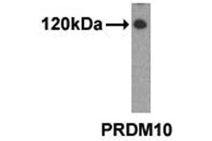 Western analysis of extracts from 293 cells using PRDM10 antibody. (PRDM10 antibody  (N-Term))