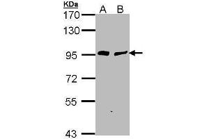 WB Image Sample (30 ug of whole cell lysate) A: H1299 B: Hela 7. (Gelsolin antibody  (C-Term))
