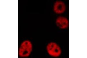 ABIN6276866 staining HeLa cells by IF/ICC. (AIRE antibody  (Internal Region))