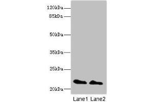 Western blot All lanes: KRAS antibody at 2 μg/mL Lane 1: Mouse brain tissue Lane 2: Mouse kidney tissue Secondary Goat polyclonal to rabbit IgG at 1/10000 dilution Predicted band size: 22 kDa Observed band size: 22 kDa (K-RAS antibody  (AA 2-168))