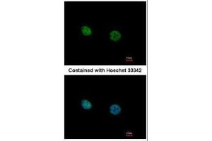 ICC/IF Image Immunofluorescence analysis of paraformaldehyde-fixed HeLa, using NR2C2, antibody at 1:500 dilution. (TR4 antibody)