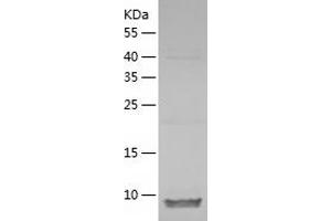 Western Blotting (WB) image for Zinc and Ring Finger Protein 1 (ZNRF1) (AA 74-178) protein (His tag) (ABIN7125764) (ZNRF1 Protein (AA 74-178) (His tag))