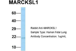 Host: Rabbit  Target Name: MARCKSL1  Sample Tissue: Human Fetal Lung  Antibody Dilution: 1. (MARCKSL1 antibody  (C-Term))