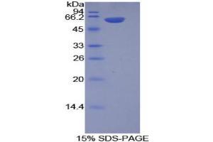 SDS-PAGE analysis of Mouse Integrin alpha 9 Protein.