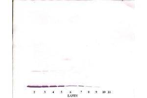 Image no. 2 for anti-Interferon gamma (IFNG) antibody (ABIN464926) (Interferon gamma antibody)