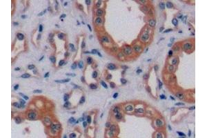 Detection of ErbB2 in Human Kidney Tissue using Polyclonal Antibody to Receptor Tyrosine Protein Kinase erbB-2 (ErbB2) (ErbB2/Her2 antibody  (AA 376-578))
