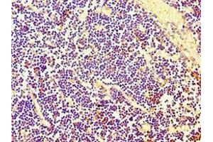 Immunohistochemistry of paraffin-embedded human thymus tissue using ABIN7158664 at dilution of 1:100 (PBK antibody  (AA 1-322))
