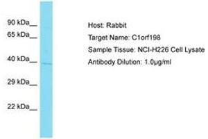 Image no. 1 for anti-Chromosome 1 Open Reading Frame 198 (C1ORF198) (AA 225-274) antibody (ABIN6750705) (C1ORF198 antibody  (AA 225-274))