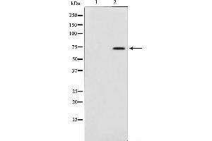 Western blot analysis on HepG2 cell lysate using MAP3K3 Antibody,The lane on the left is treated with the antigen-specific peptide. (MAP3K3 antibody)
