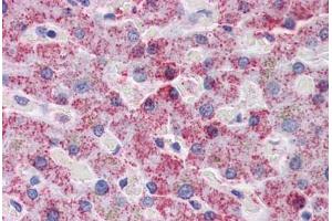 Human Liver: Formalin-Fixed, Paraffin-Embedded (FFPE)