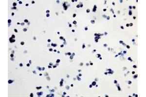 ICC staining of formalin fixed and paraffin embedded human SW40 cells (400X, Negative) with recombinant BRAF V600E antibody. (Recombinant BRAF antibody  (V600E))