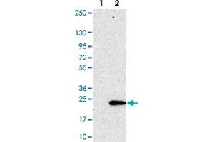 Western blot analysis of Lane 1: Negative control (vector only transfected HEK293T lysate). (SEC11C antibody)