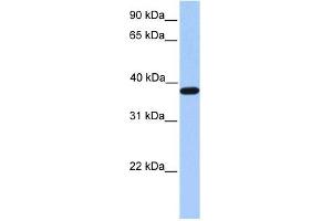 ACTRT2 antibody used at 1 ug/ml to detect target protein. (ACTRT2 antibody  (C-Term))